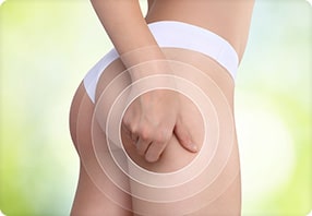 Cellulite Treatment by Dr. Jack G. Bertolino, MD - Smooth Solutions Medical Aesthetics in Williamsville, Buffalo, NY