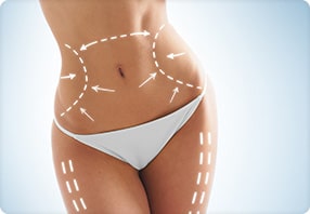 Vaser Hi Definition Liposuction or Liposculpture by Dr. Jack G. Bertolino, MD - Smooth Solutions Medical Aesthetics in Williamsville, Buffalo, NY
