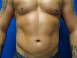 After Image: Patient # 50921 - 