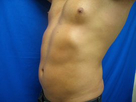 After Image: Patient # 50921 - 