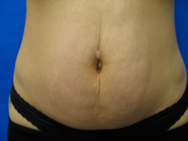 After Image: Patient # 78387 - 