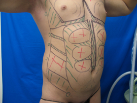 Before Image: Patient # 50921 - 