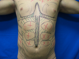 Before Image: Patient # 50921 - 