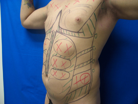 Before Image: Patient # 50921 - 