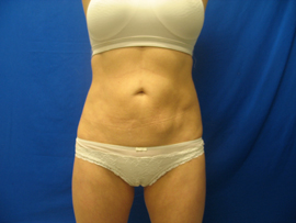 After Image: Patient # 13083 - 