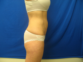 After Image: Patient # 13083 - 