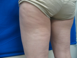 Before Image: Patient # 16455 - 