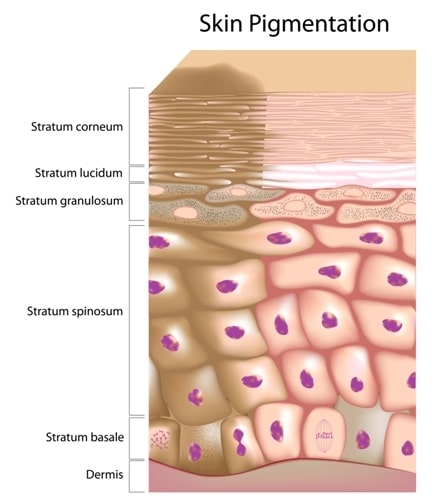 Intense Pulsed Light Therapy in Buffalo, NY | Smooth Solutions