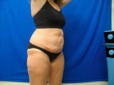 After Image: Patient # 42573 - 
