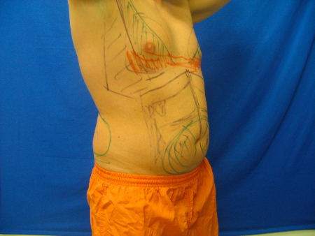 Before Image: Patient # 51865 - 