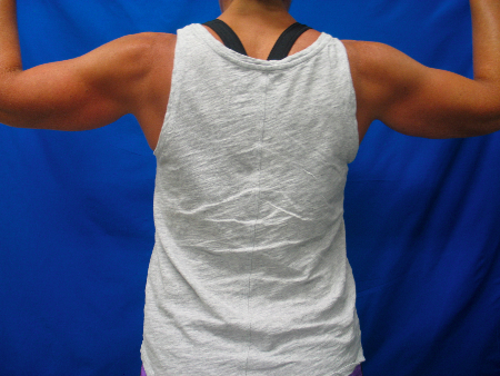 After Image: Patient # 79587 - 