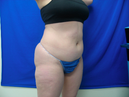 Before Image: Patient # 12078
