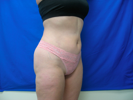 After Image: Patient # 12078