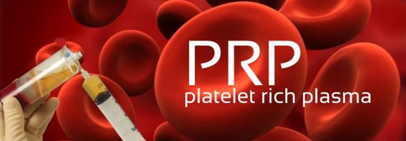 Platelet- rich plasma treatment in Buffalo NY
