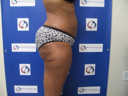 After Image: Patient # 14331 - 