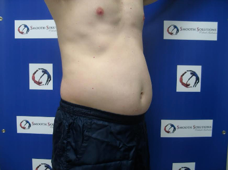 Before Image: Patient # 11139 - 