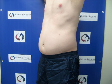Before Image: Patient # 11139 - 