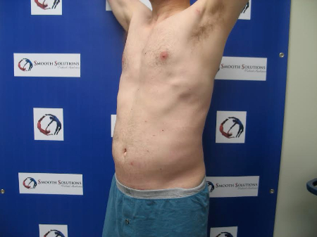 After Image: Patient # 11139 - 