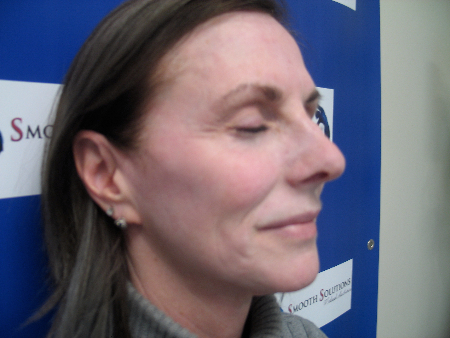 Before Image: Patient # 71058 - 