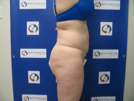 Before Image: Patient # 50823 - 