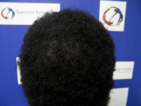 After Image: Patient # 60669 - 