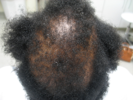 Before Image: Patient # 60669 - 