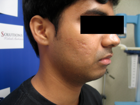 After Image: Patient # 81461 - 