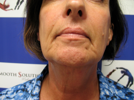 Before Image: Patient # 66780 - 