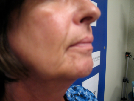 Before Image: Patient # 66780 - 