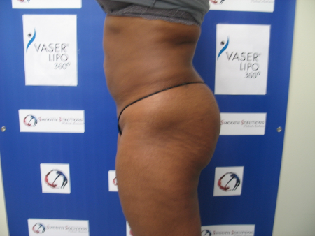 After Image: Patient # 32226 - 