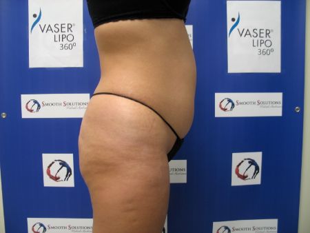 Before Image: Patient # 70267 - 