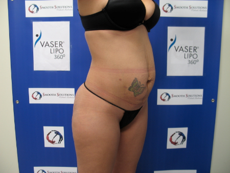 After Image: Patient # 63990 - 