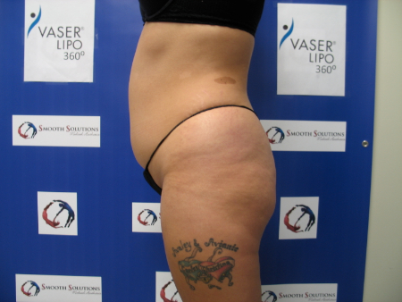 Before Image: Patient # 70267 - 