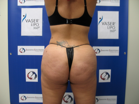 After Image: Patient # 70267 - 
