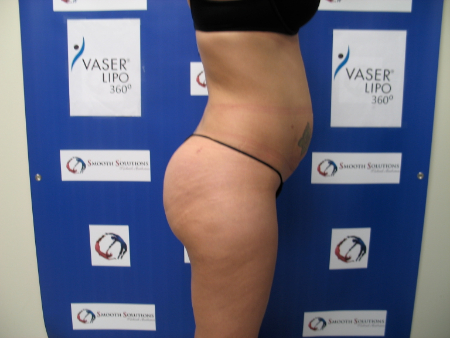 After Image: Patient # 63990 - 