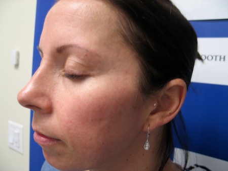 After Image: Patient # 50052 - 
