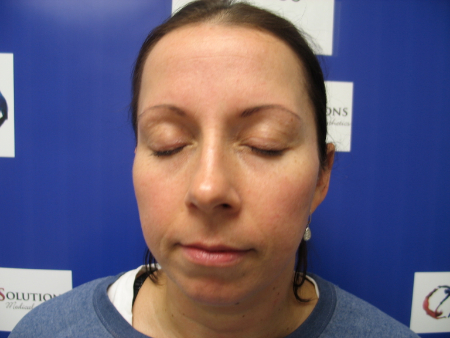 After Image: Patient # 50052 - 