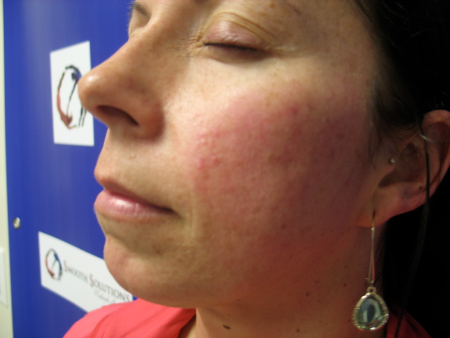 Before Image: Patient # 50052 - 