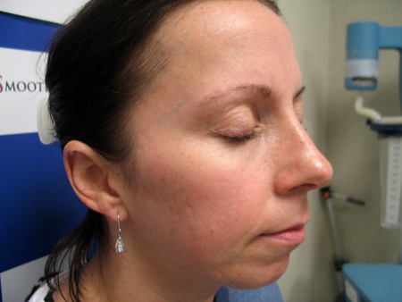 After Image: Patient # 50052 - 
