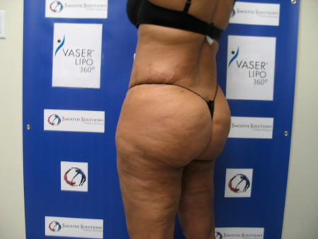 After Image: Patient # 79480 - 
