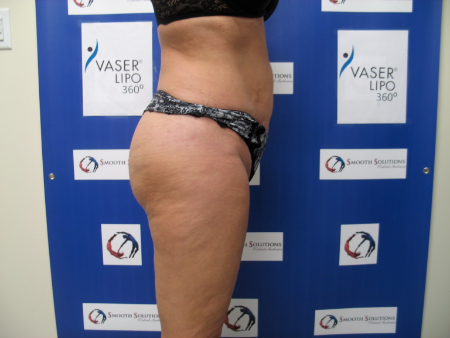 After Image: Patient # 83114 - 
