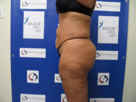 After Image: Patient # 79480 - 