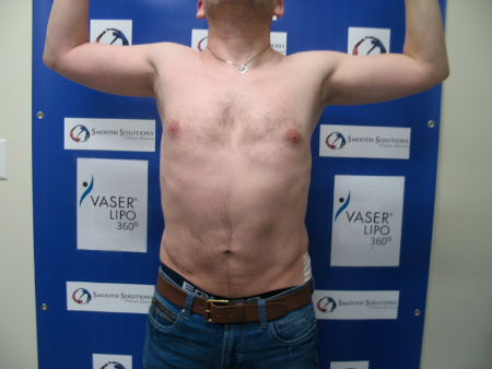 After Image: Patient # 44831 - 