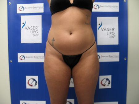 Before Image: Patient # 54169 - 