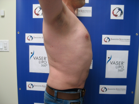 After Image: Patient # 44831 - 
