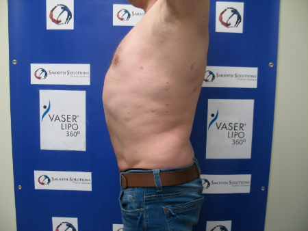 After Image: Patient # 44831 - 