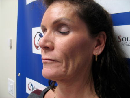 Before Image: Patient # 27223 - 