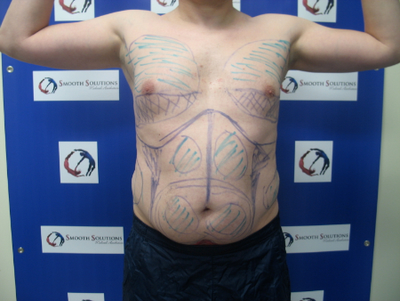 Before Image: Patient # 44831 - 