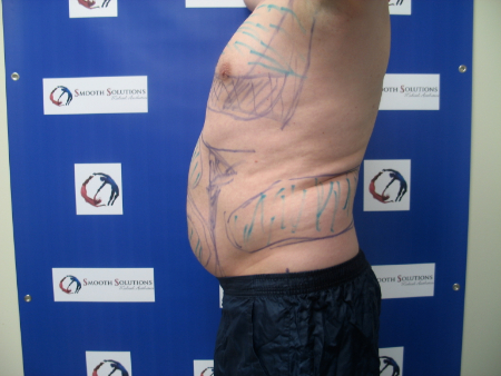 Before Image: Patient # 44831 - 