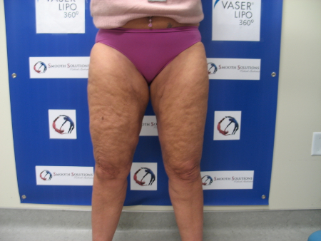 After Image: Patient # 84436